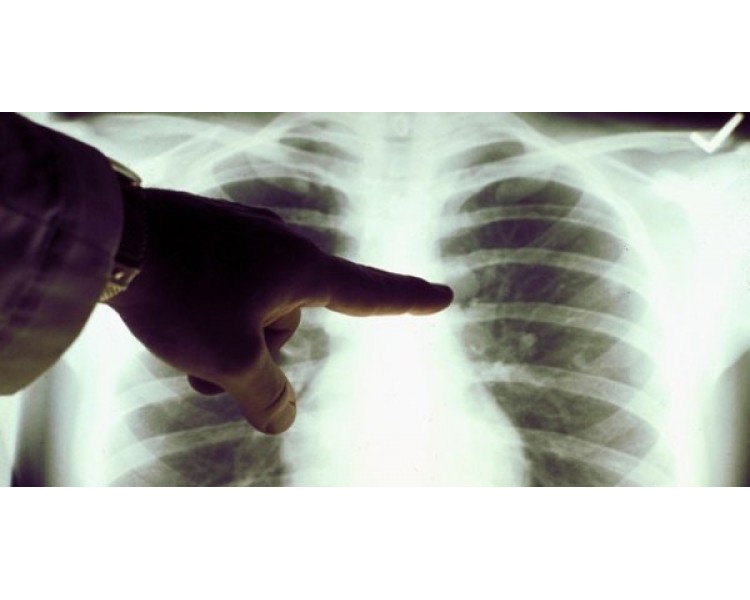 欧美新研究表明：VAPE蒸汽对肺部细胞无毒副作用(图1)